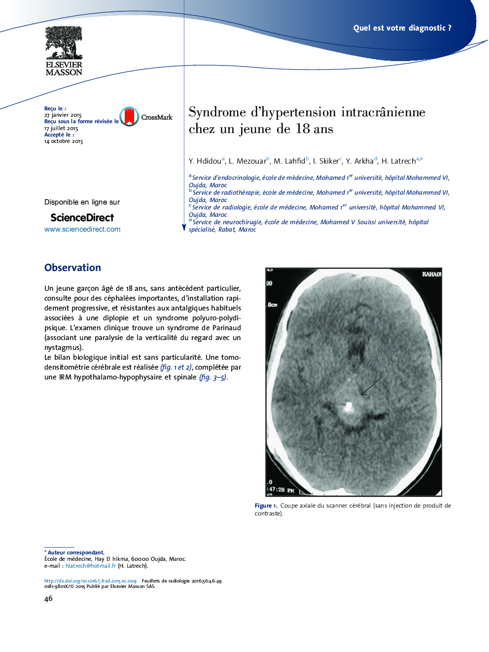 عکس صفحه اول مقاله: Syndrome d'hypertension intracrânienne chez un jeune de 18 ans Syndrome d'hypertension intracrânienne chez un jeune de 18 ans