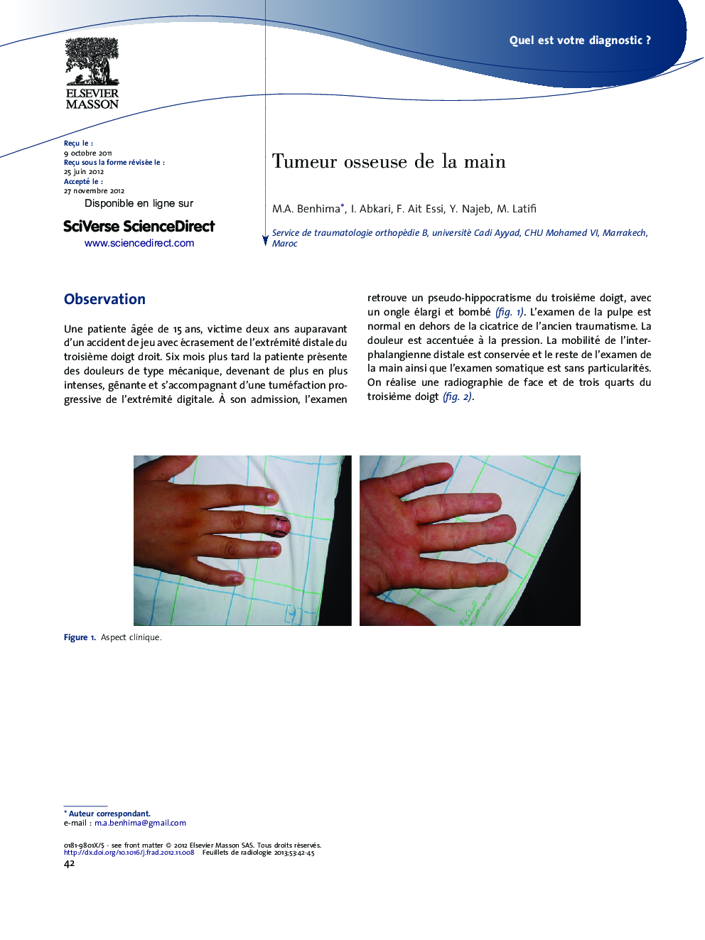 عکس صفحه اول مقاله: Tumeur osseuse de la main Tumeur osseuse de la main