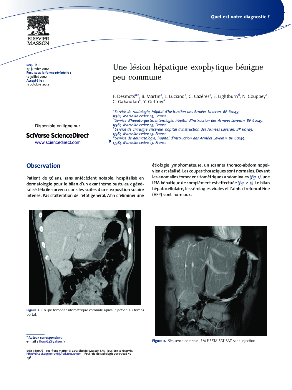 عکس صفحه اول مقاله: Une lésion hépatique exophytique bénigne peu commune Une lésion hépatique exophytique bénigne peu commune