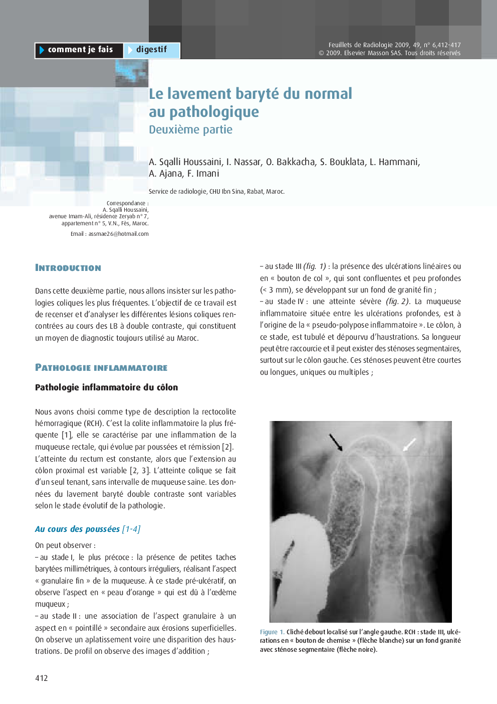 Le lavement baryté du normal au pathologique