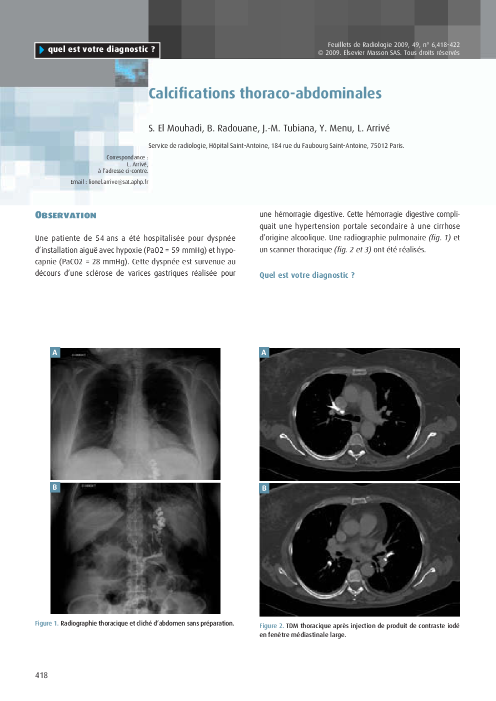 عکس صفحه اول مقاله: Calcifications thoraco-abdominales Calcifications thoraco-abdominales