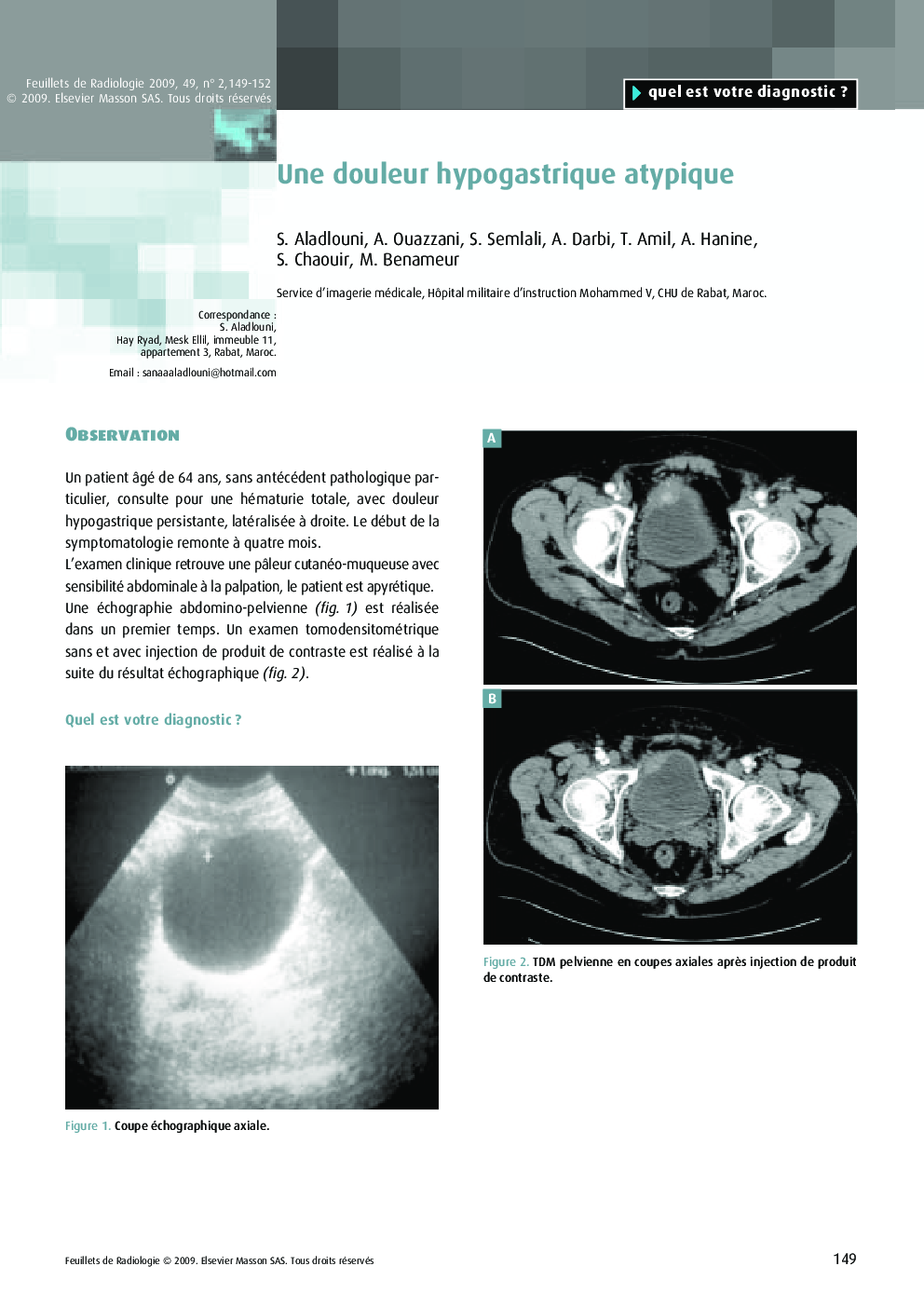 Une douleur hypogastrique atypique