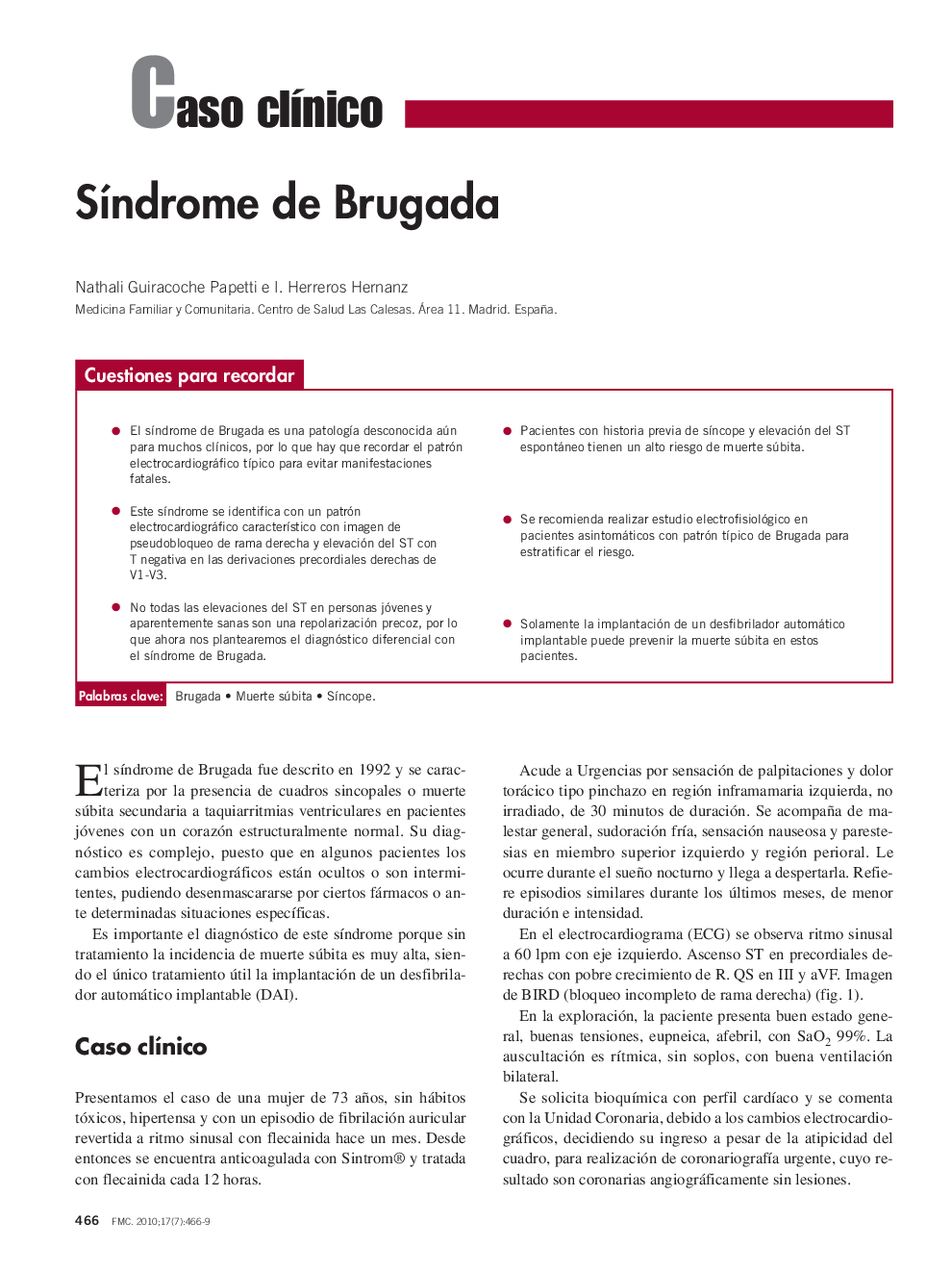 SÃ­ndrome de Brugada