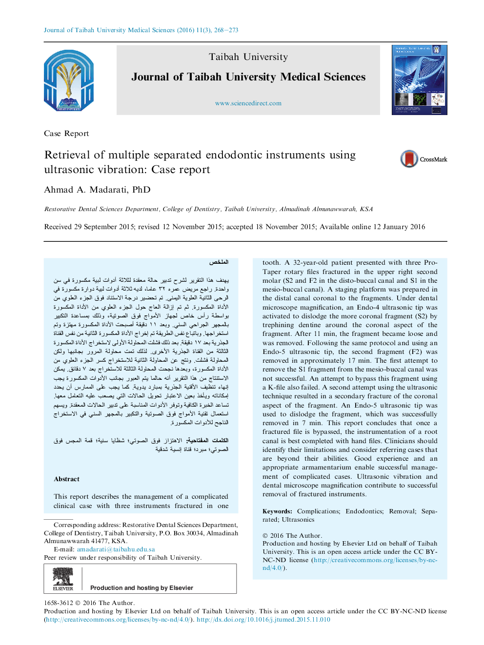 بازیابی ابزارهای اندودنتیک چندگانه با استفاده از ارتعاشات اولتراسونیک: گزارش مورد 