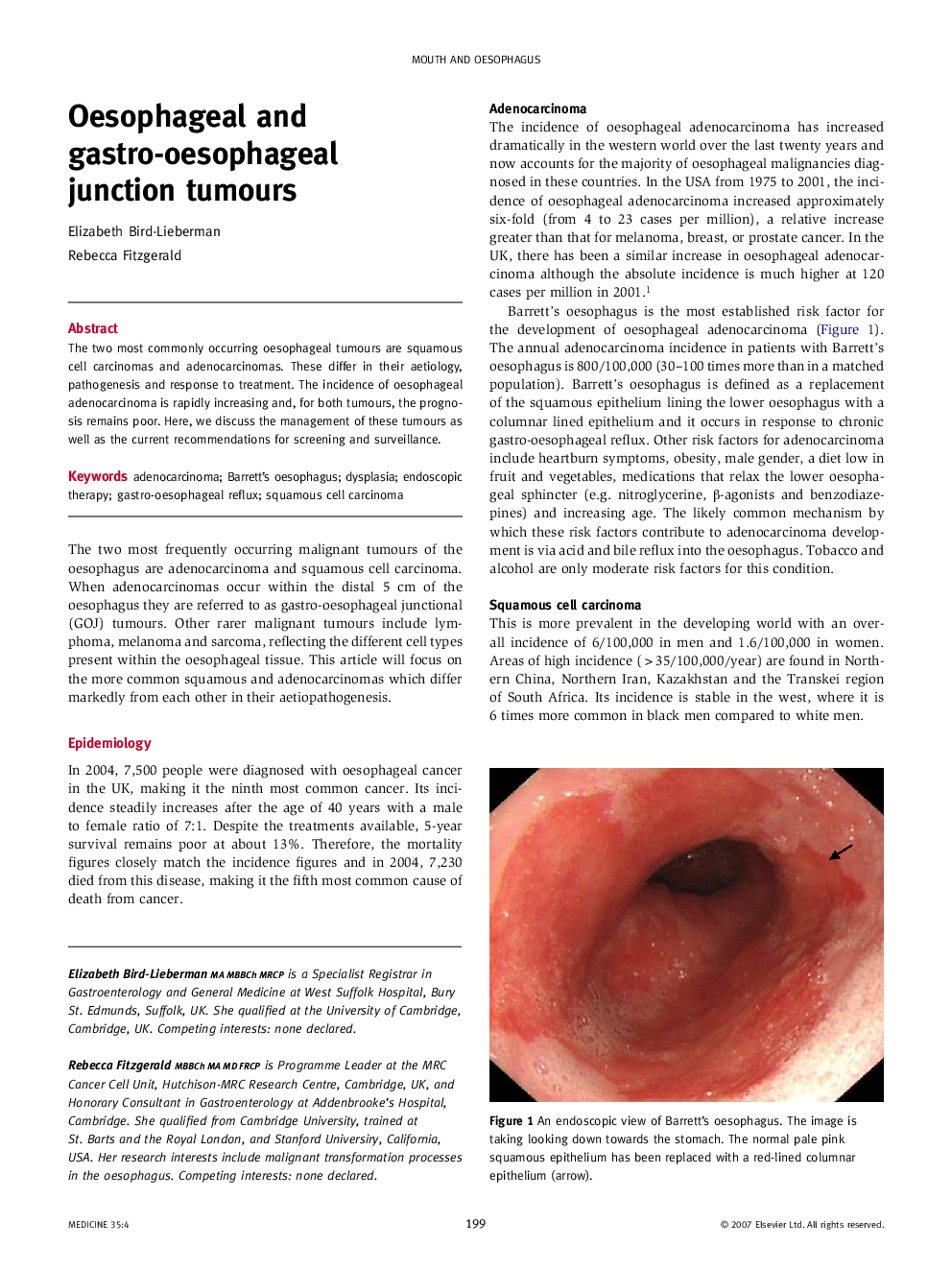 Oesophageal and gastro-oesophageal junction tumours