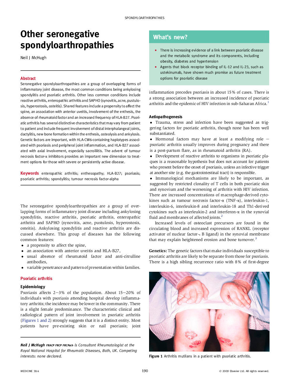 Other seronegative spondyloarthropathies