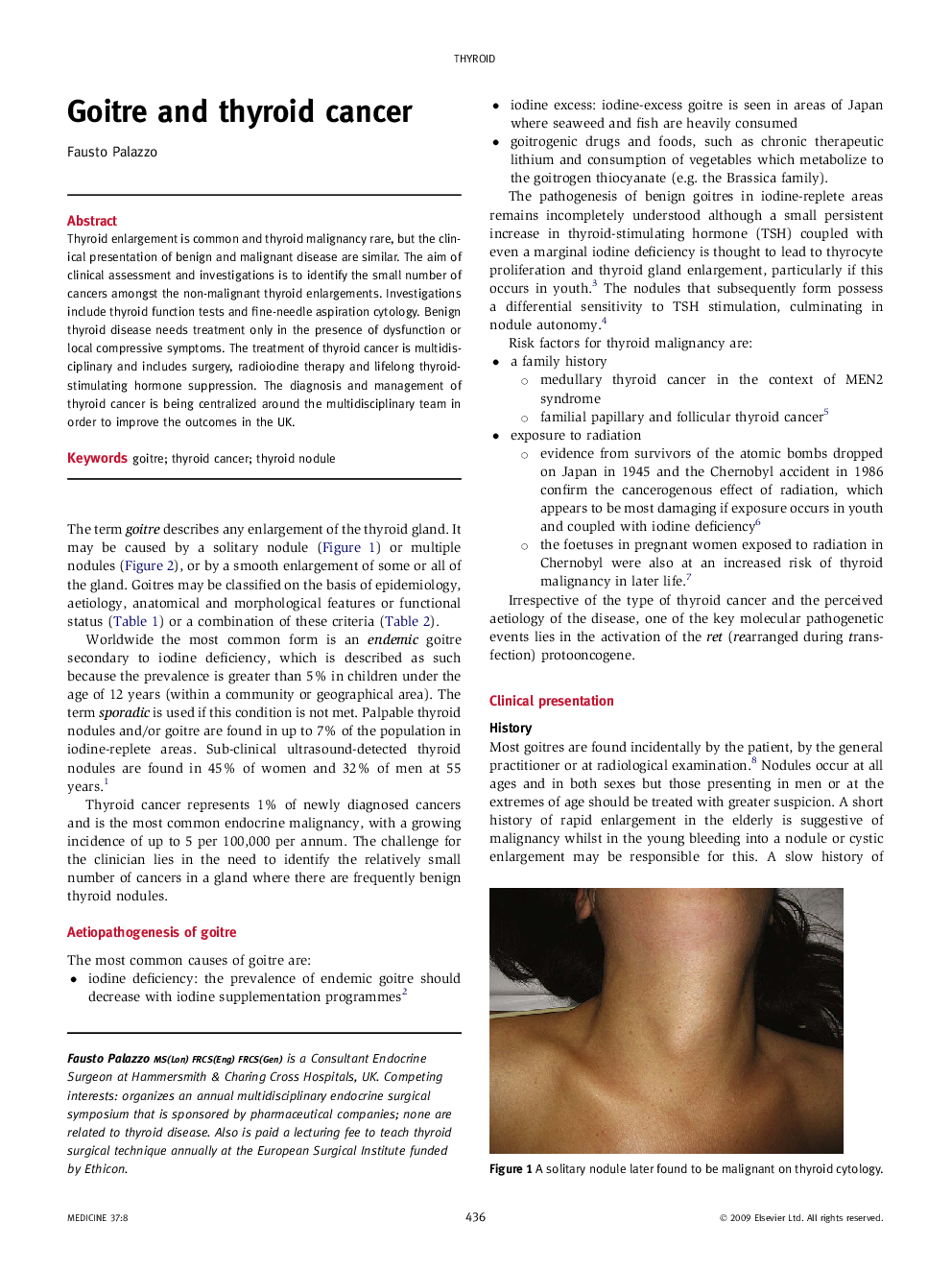 Goitre and thyroid cancer