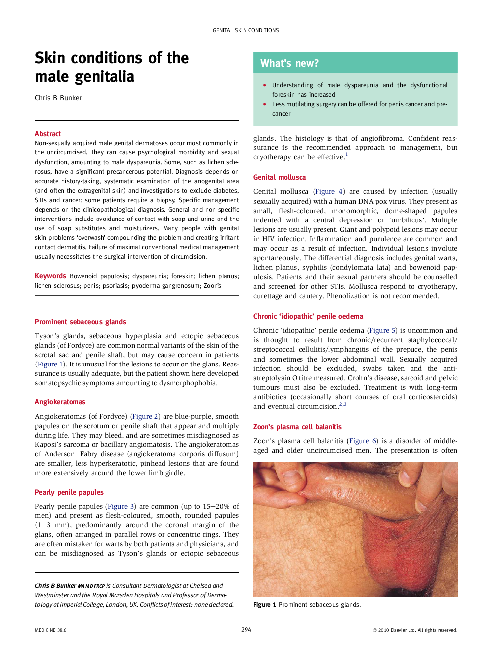 Skin conditions of the male genitalia