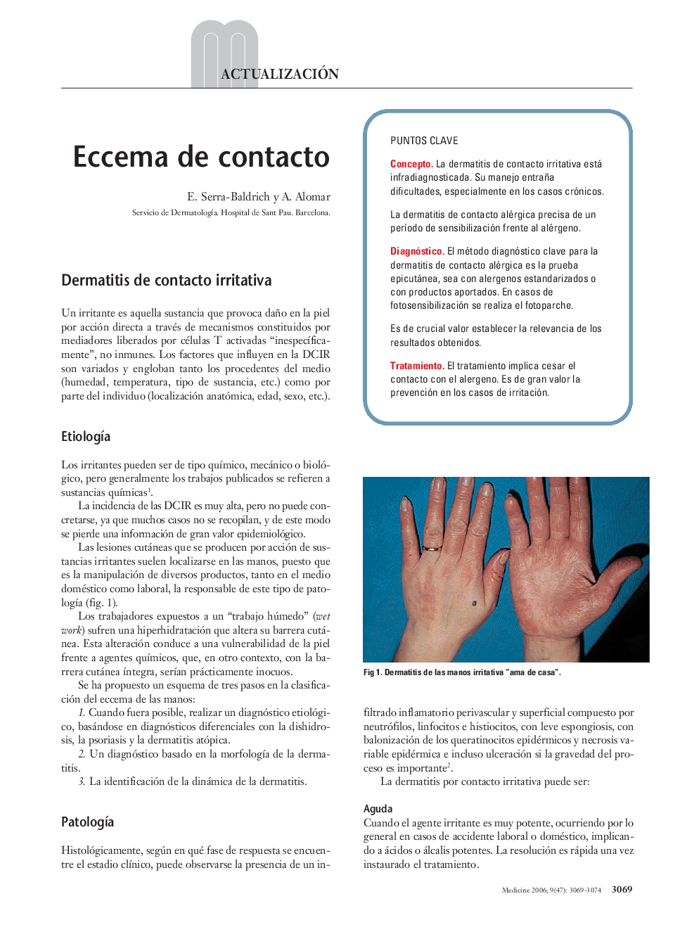 Eccema de contacto