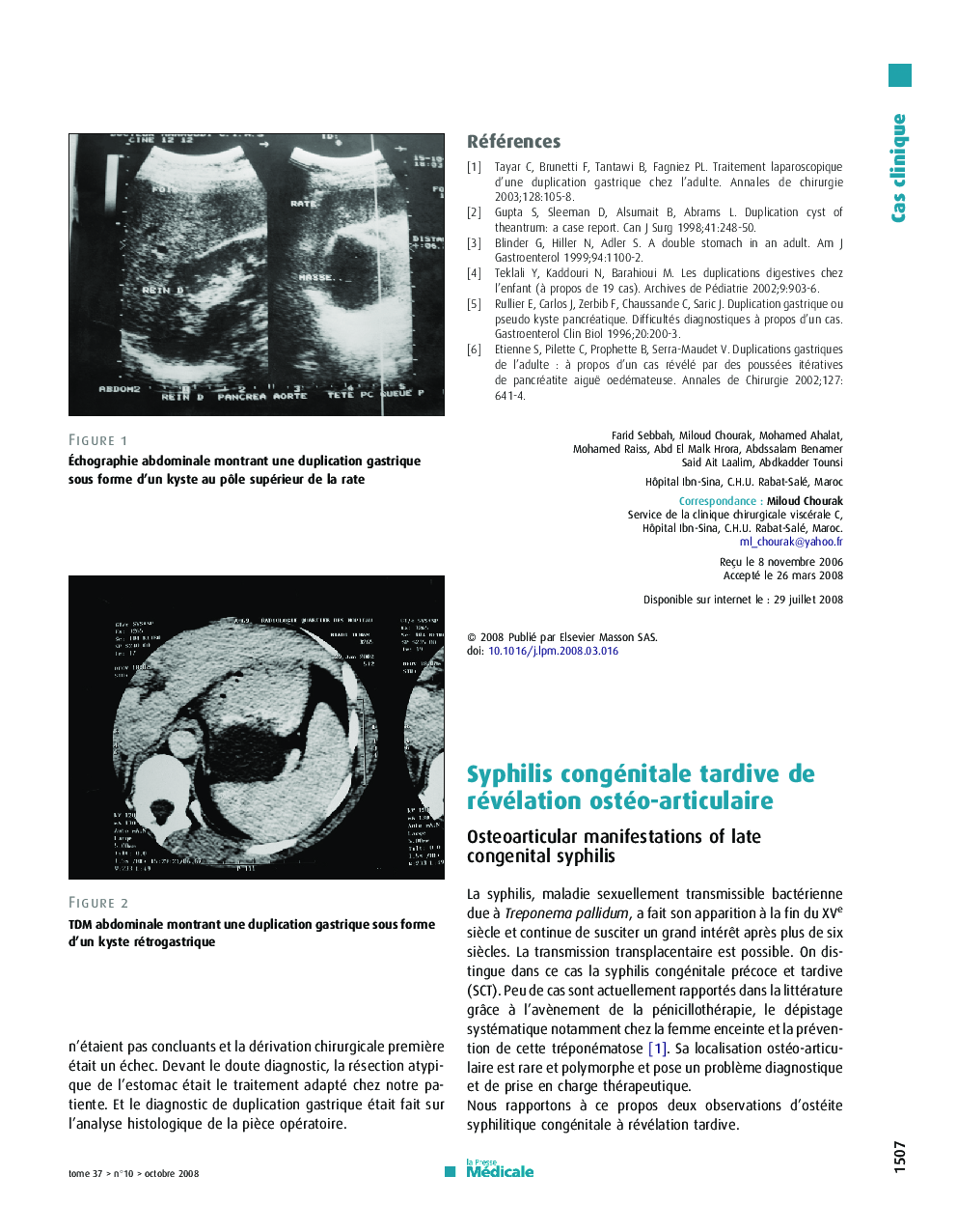 Syphilis congénitale tardive de révélation ostéo-articulaire