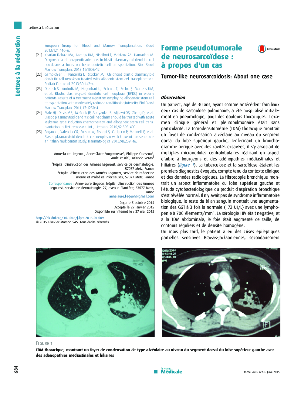 Forme pseudotumorale de neurosarcoïdoseÂ : Ã  propos d'un cas