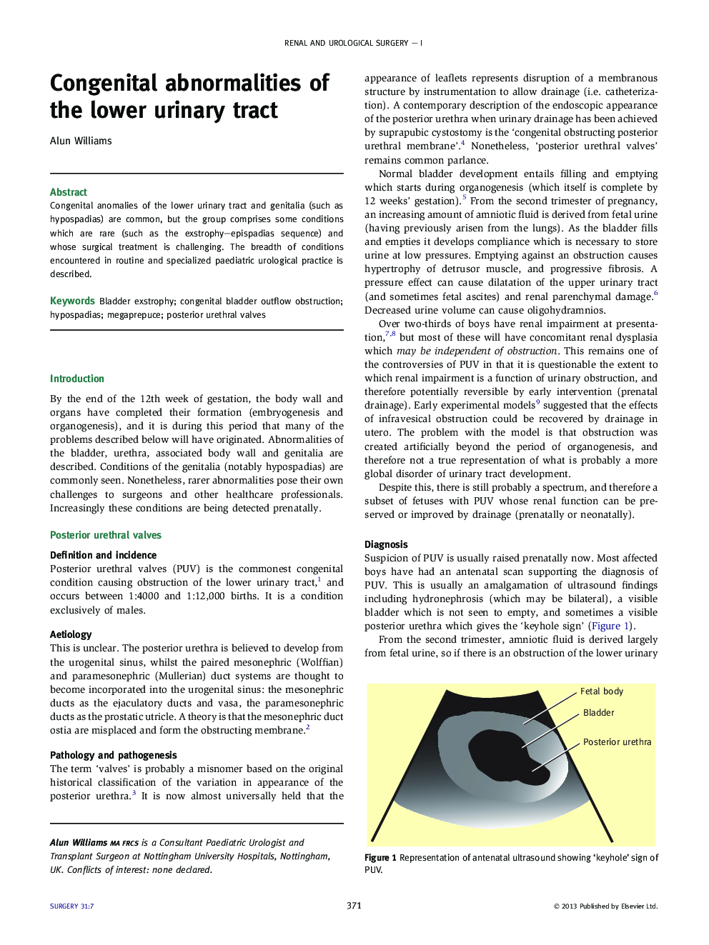 Congenital abnormalities of the lower urinary tract