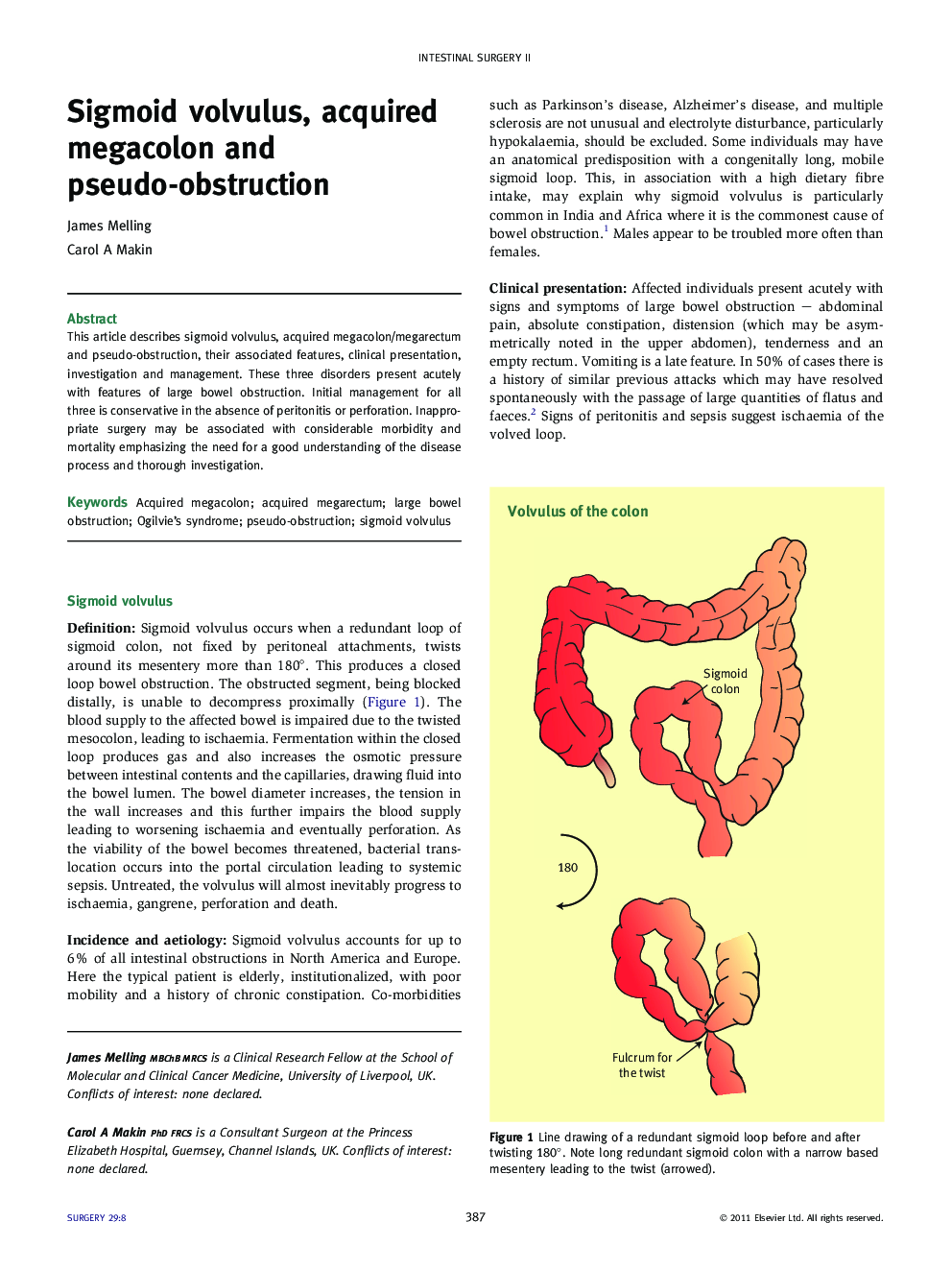 Sigmoid volvulus, acquired megacolon and pseudo-obstruction