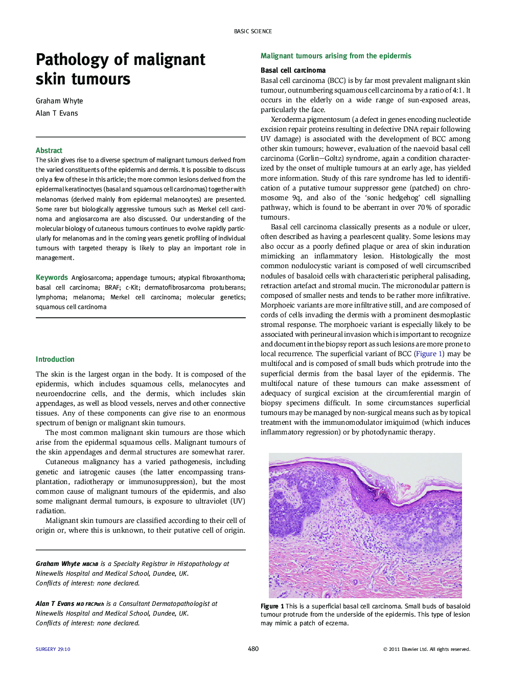 Pathology of malignant skin tumours