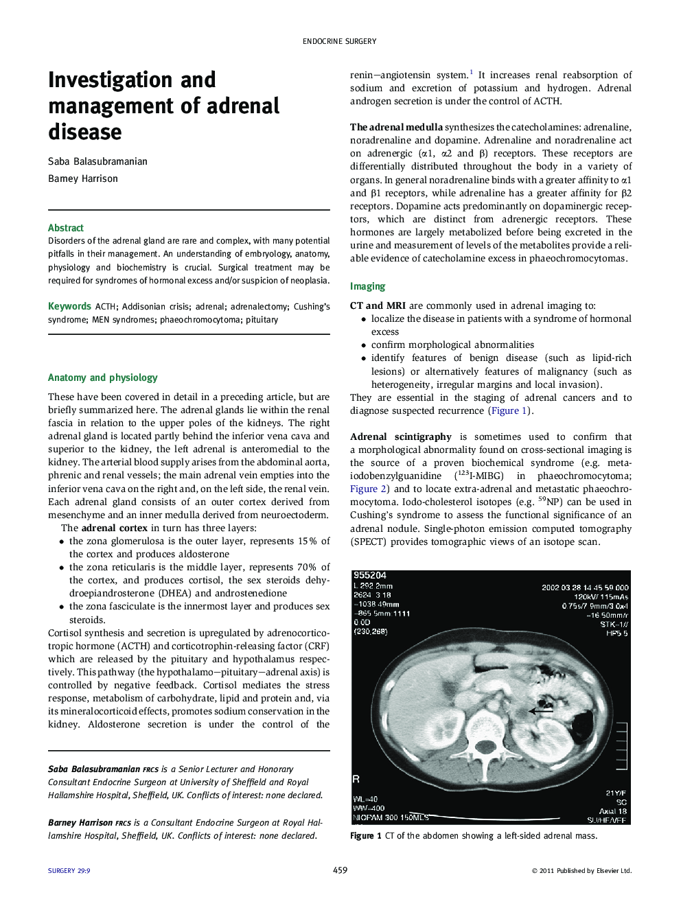 Investigation and management of adrenal disease