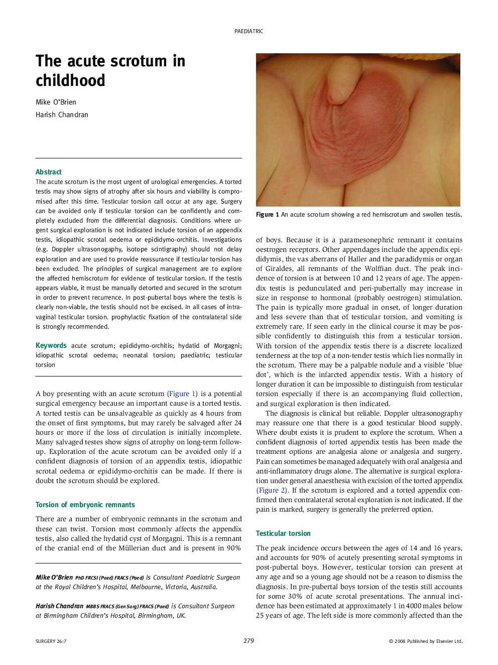 The acute scrotum in childhood