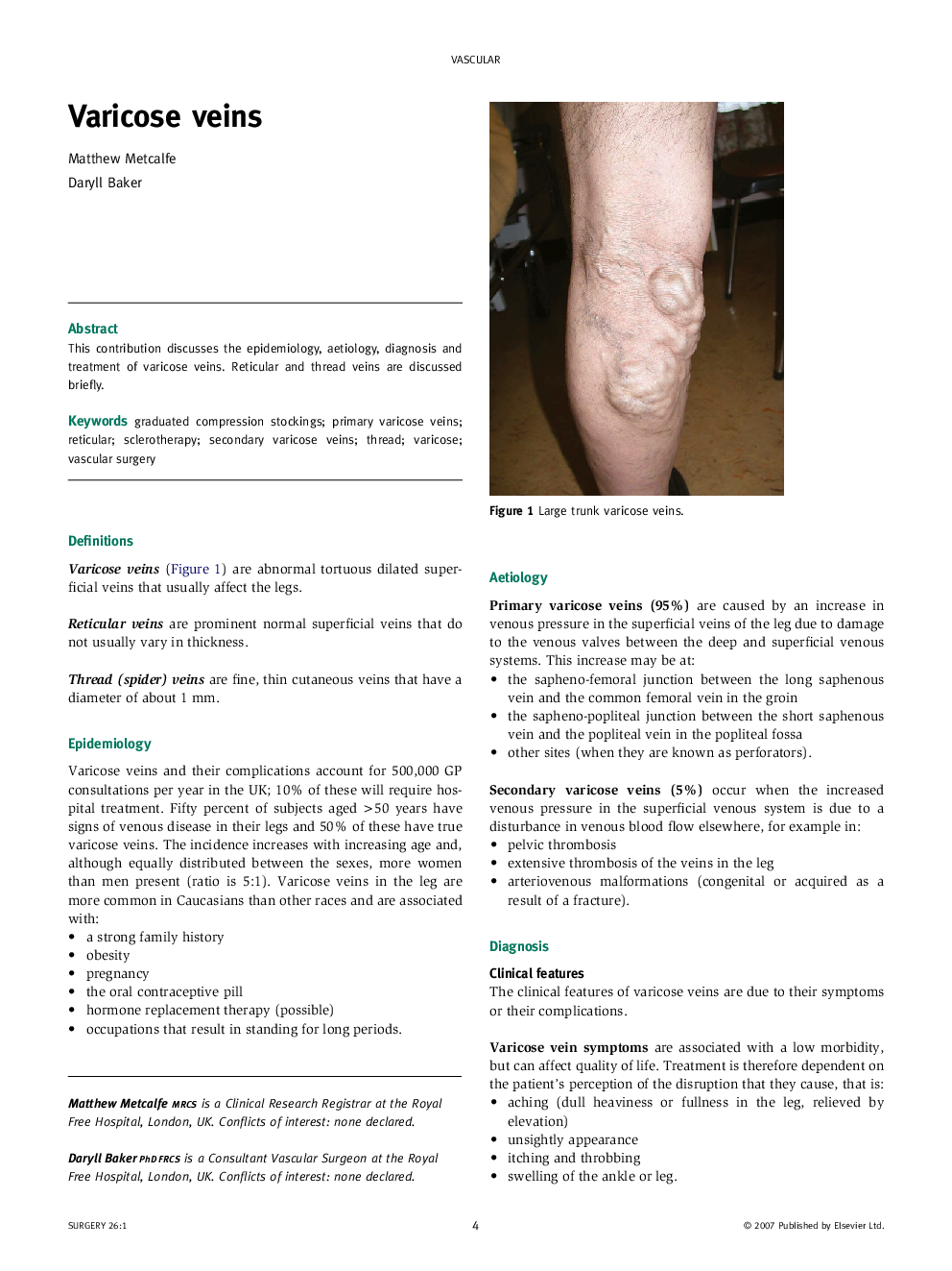 Varicose veins