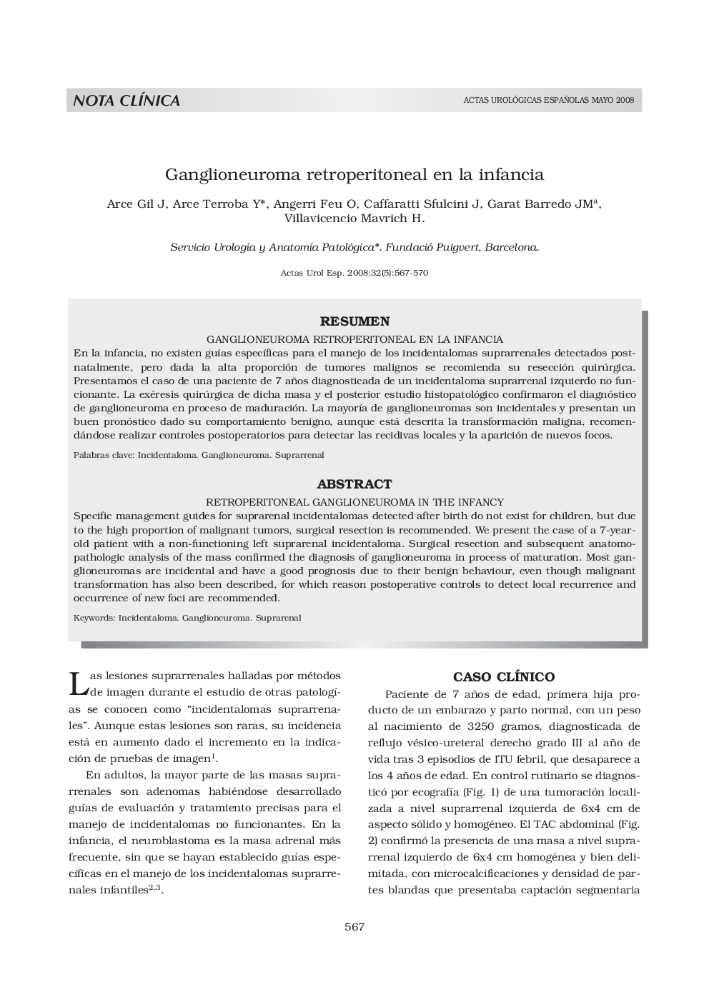 Ganglioneuroma retroperitoneal en la infancia
