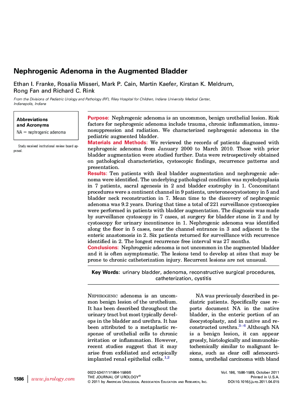 Nephrogenic Adenoma in the Augmented Bladder