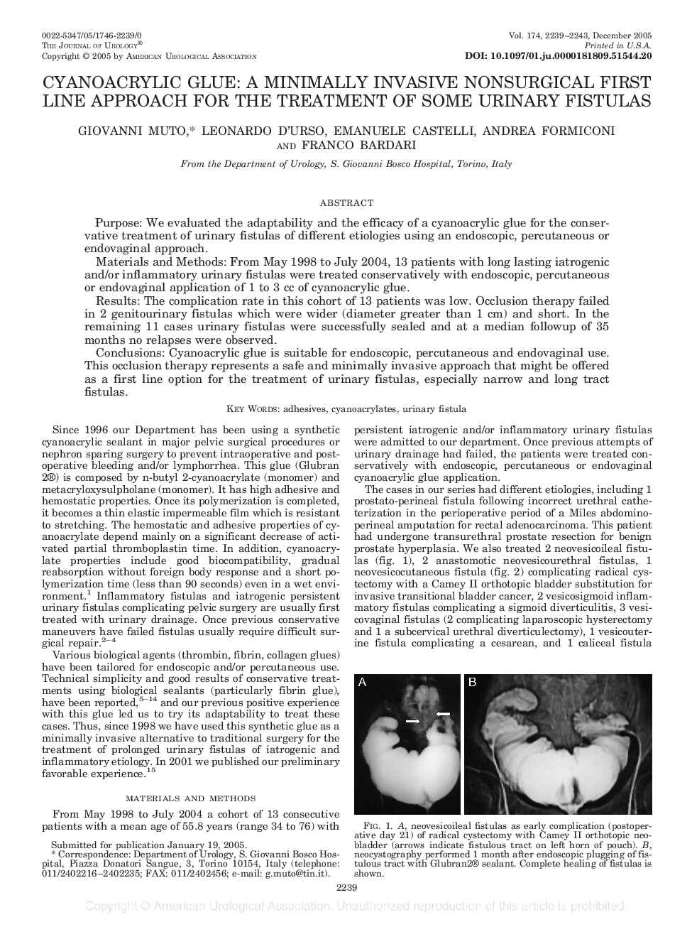 CYANOACRYLIC GLUE: A MINIMALLY INVASIVE NONSURGICAL FIRST LINE APPROACH FOR THE TREATMENT OF SOME URINARY FISTULAS