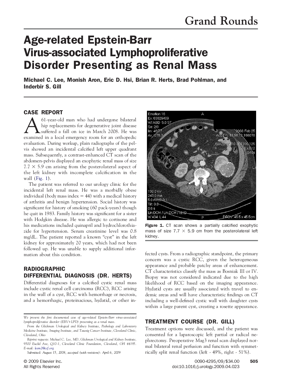 Age-related Epstein-Barr Virus-associated Lymphoproliferative Disorder Presenting as Renal Mass