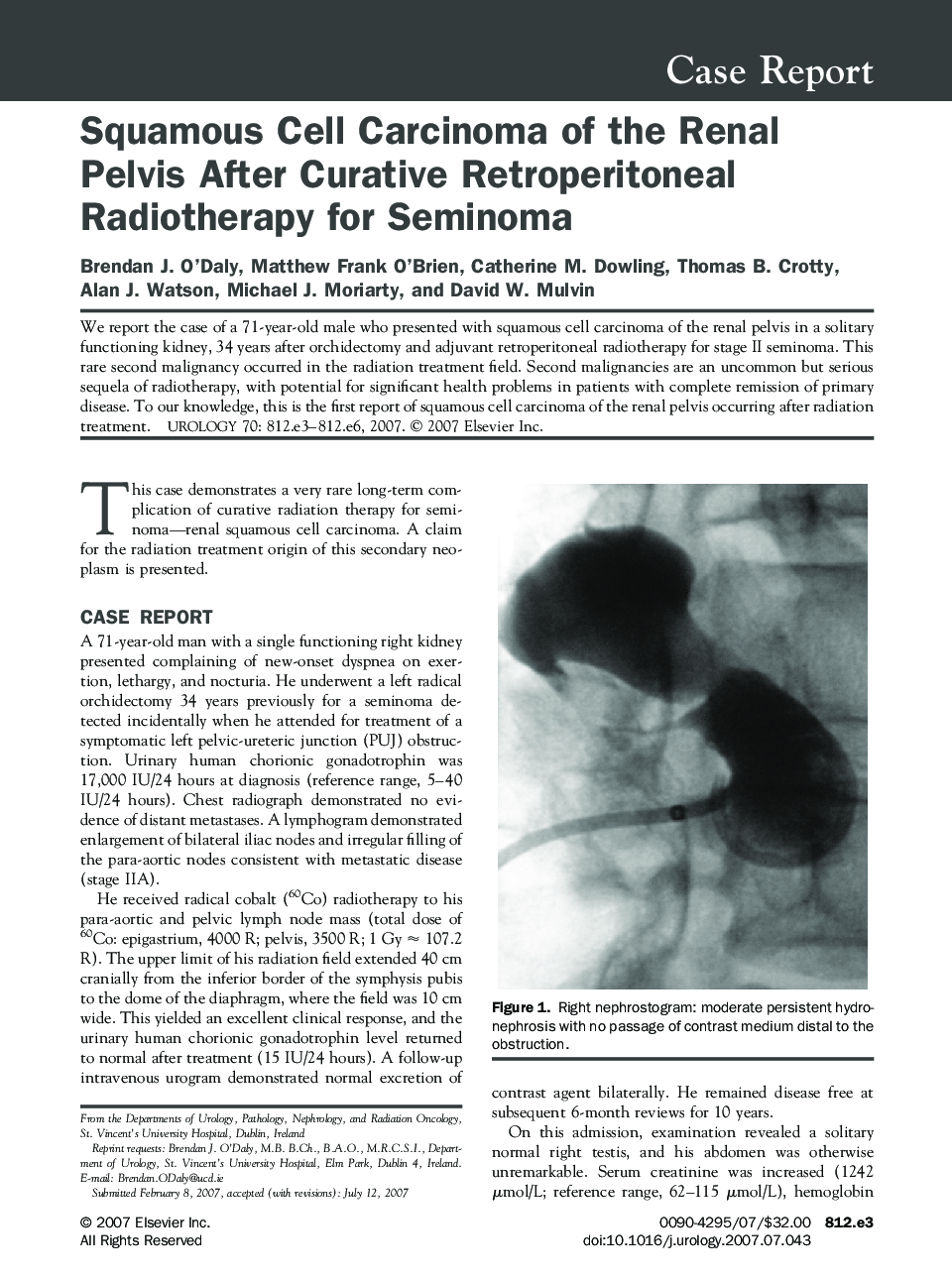 Squamous Cell Carcinoma of the Renal Pelvis After Curative Retroperitoneal Radiotherapy for Seminoma