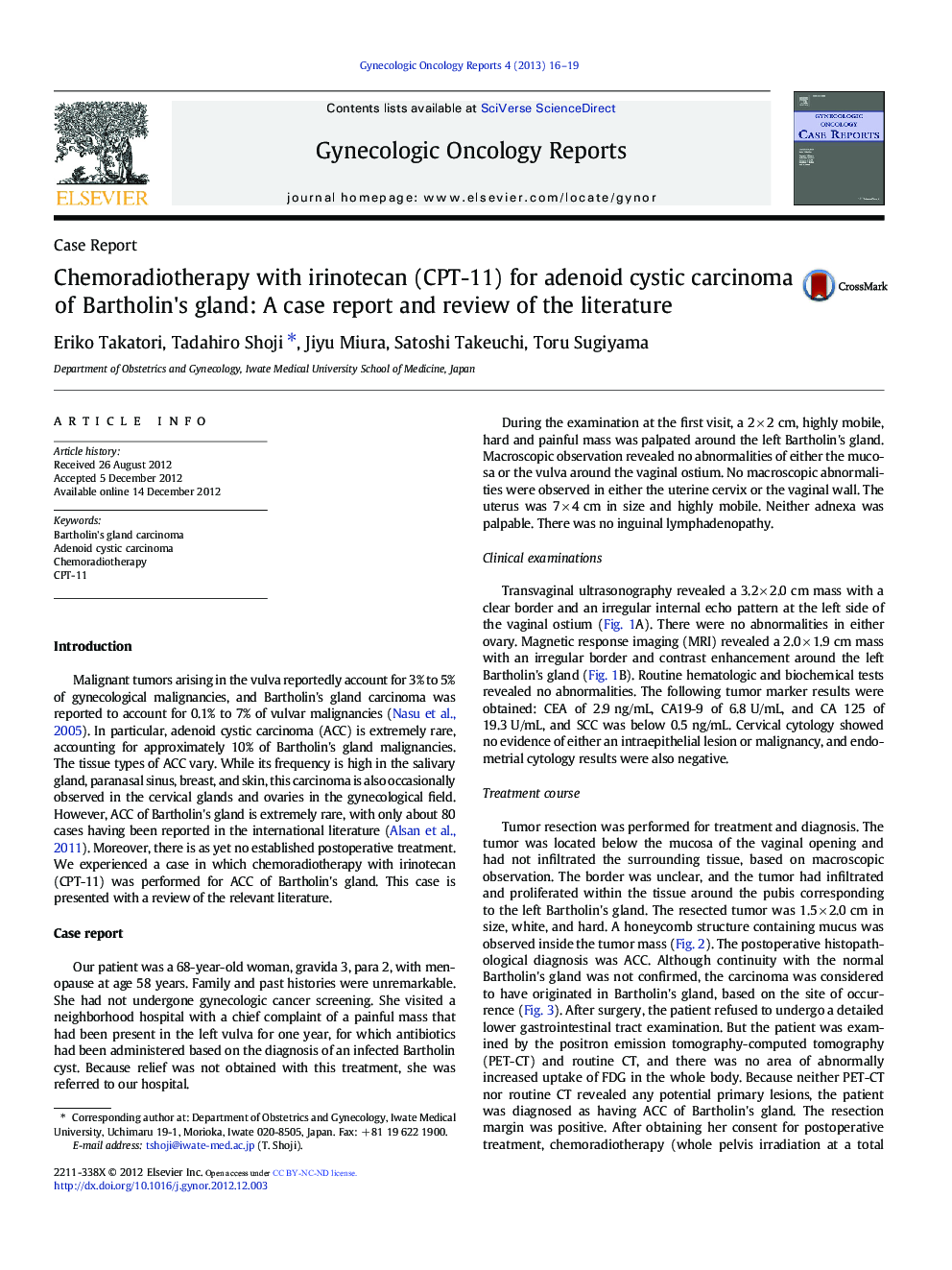 Chemoradiotherapy with irinotecan (CPT-11) for adenoid cystic carcinoma of Bartholin's gland: A case report and review of the literature