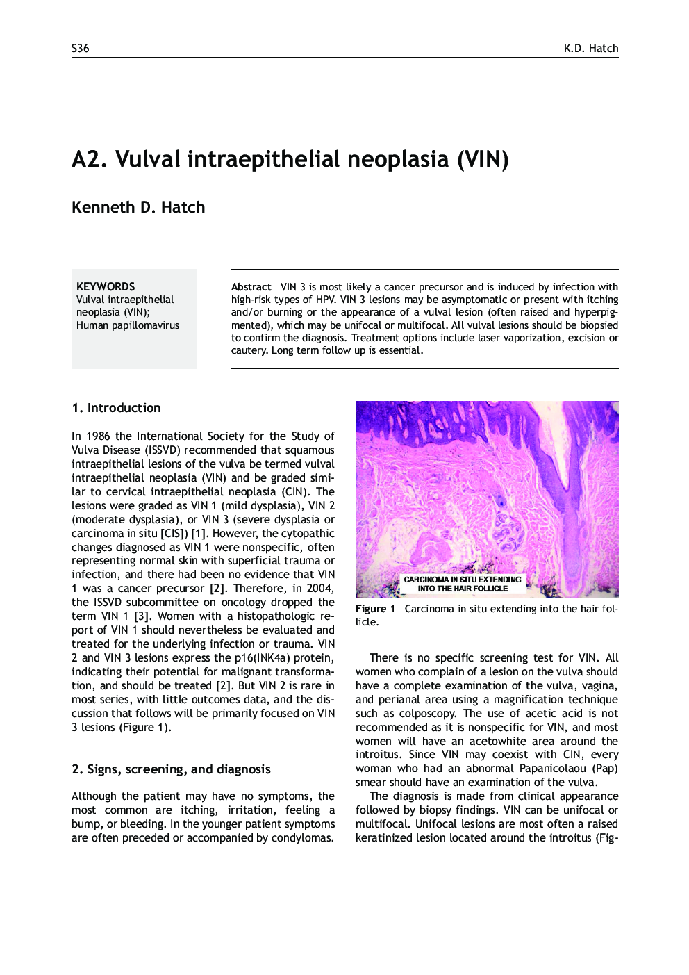عکس صفحه اول مقاله: A2. Vulval intraepithelial neoplasia (VIN) A2. Vulval intraepithelial neoplasia (VIN)