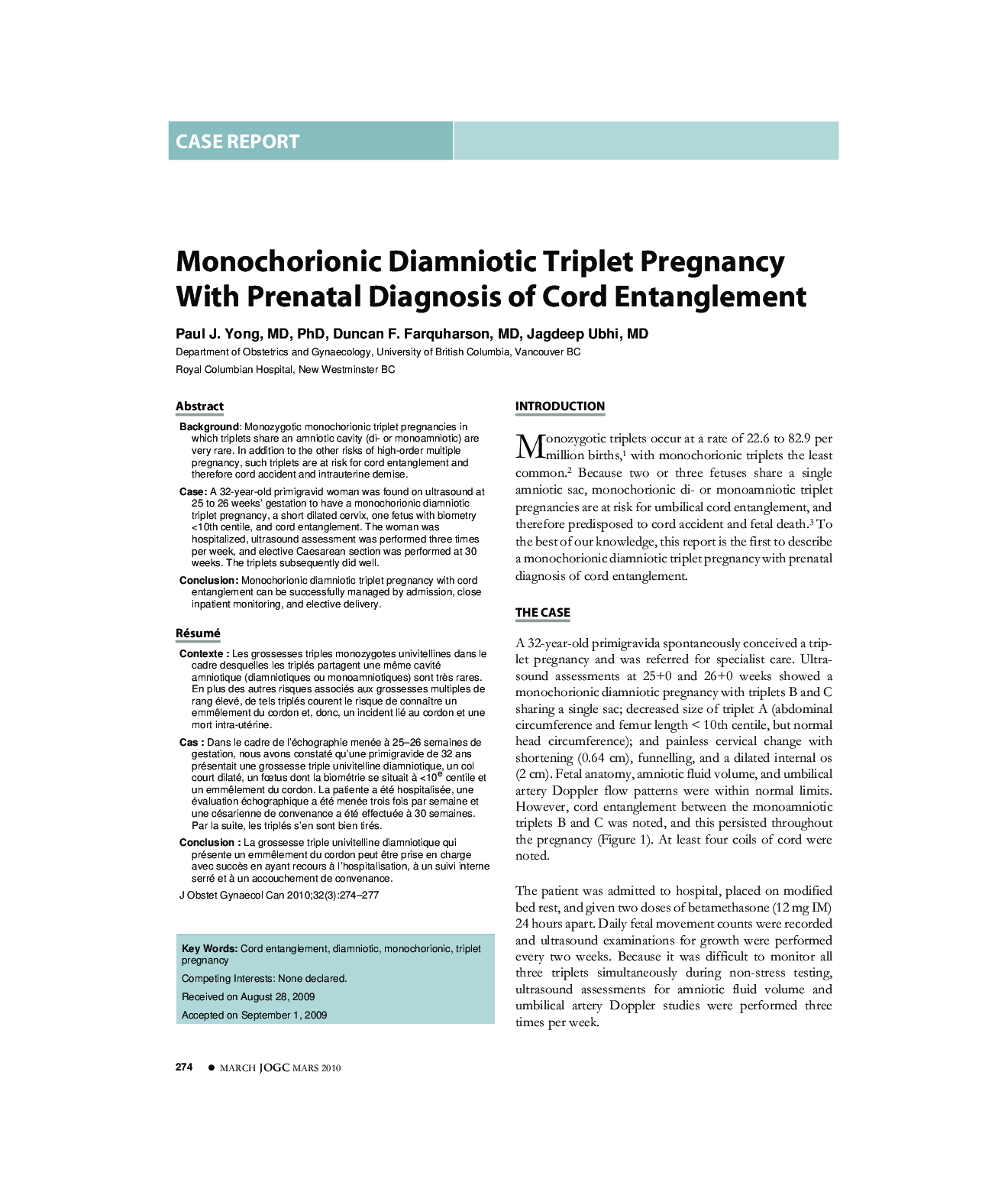 Monochorionic Diamniotic Triplet Pregnancy With Prenatal Diagnosis of Cord Entanglement