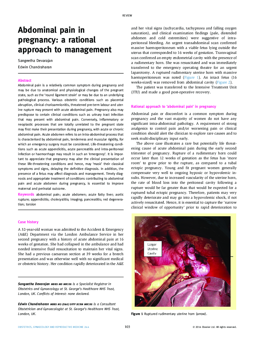 Abdominal pain in pregnancy: a rational approach to management