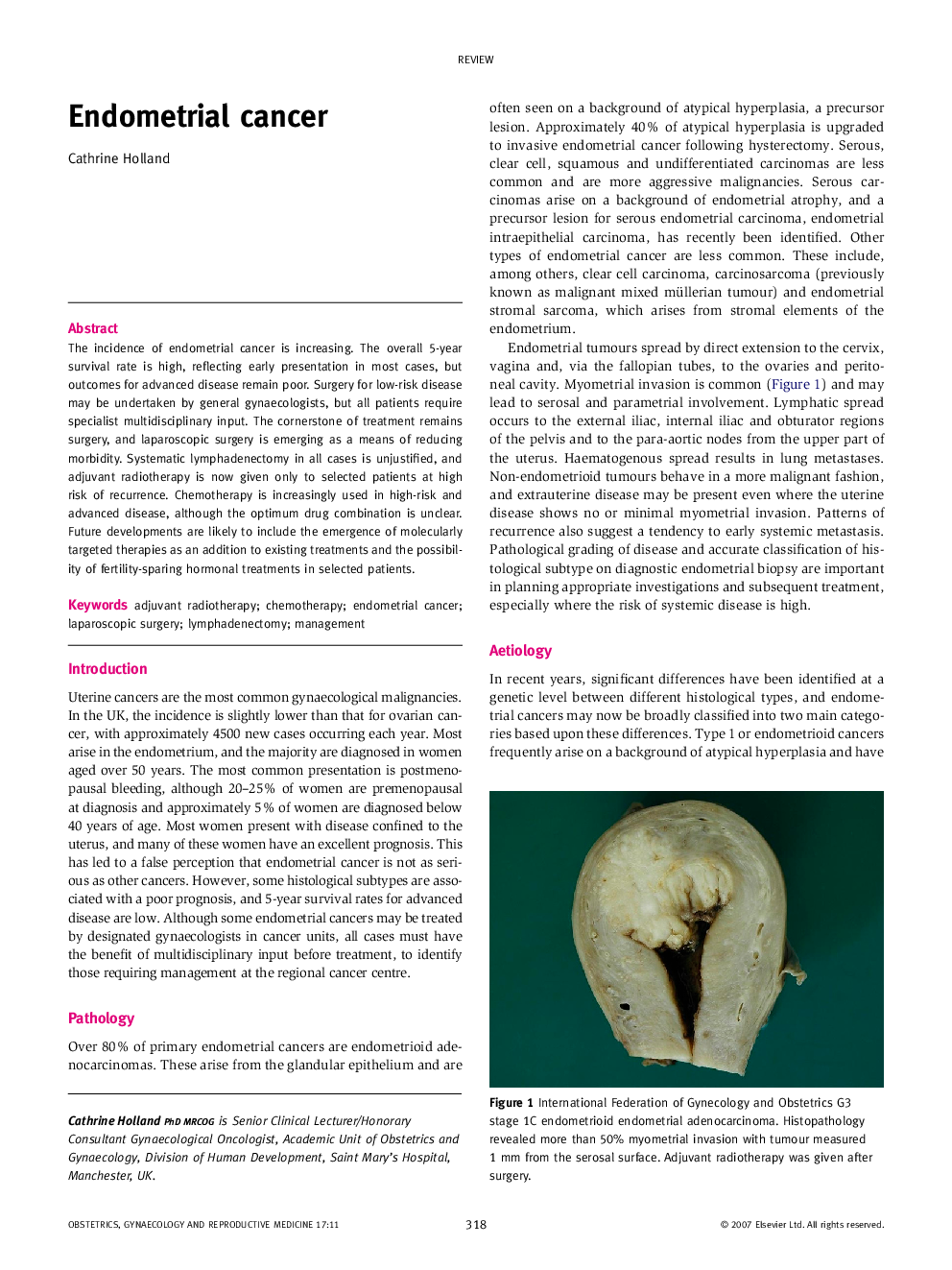 Endometrial cancer