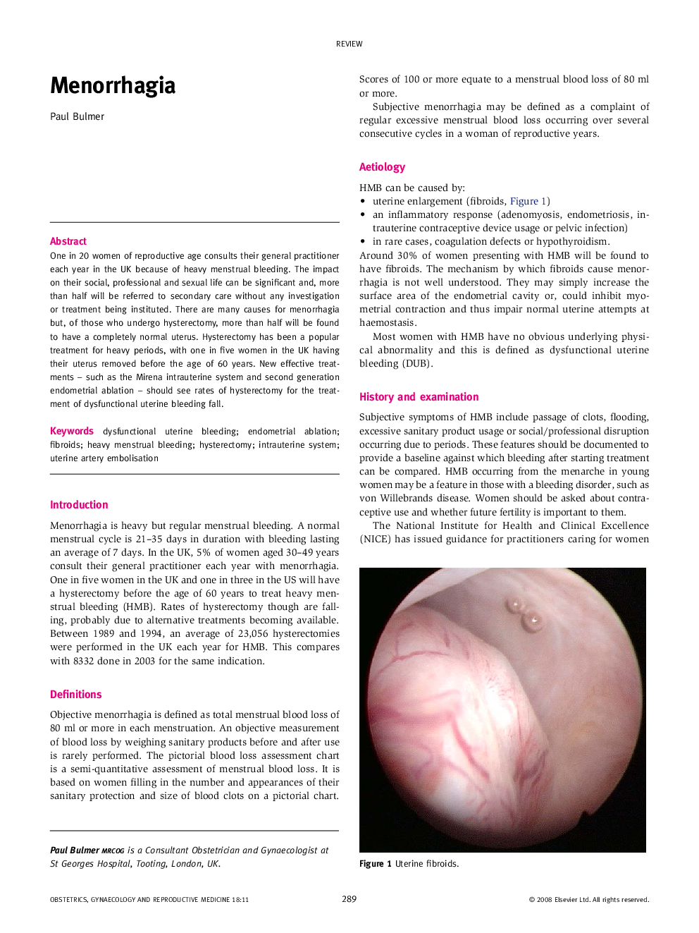 Menorrhagia