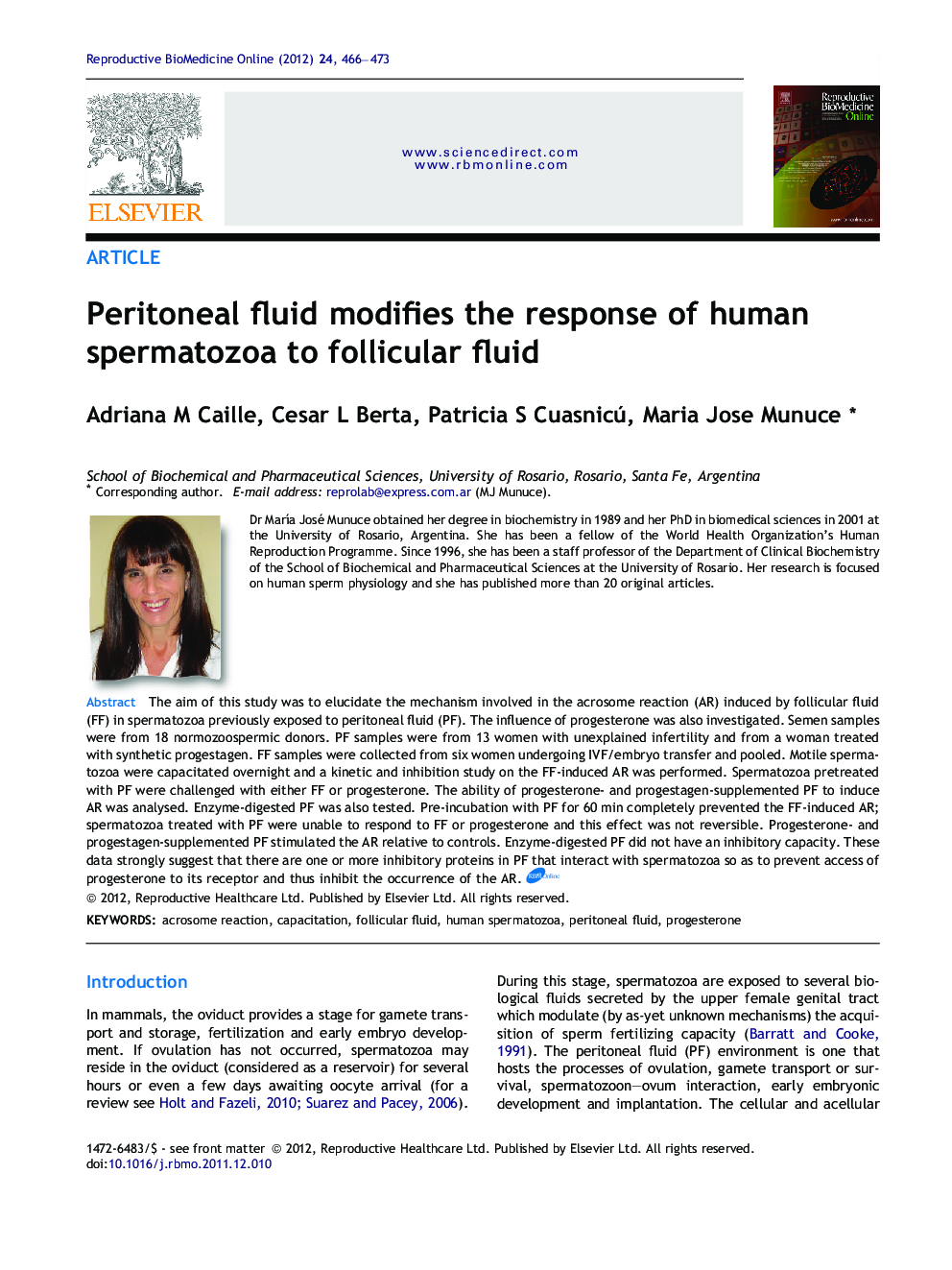 Peritoneal fluid modifies the response of human spermatozoa to follicular fluid 