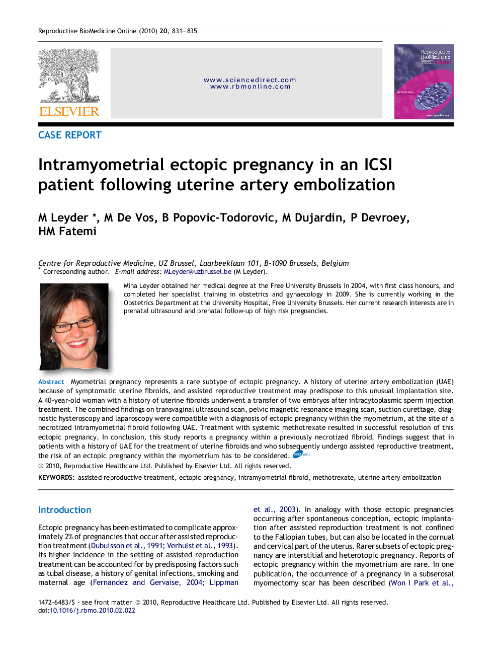 Intramyometrial ectopic pregnancy in an ICSI patient following uterine artery embolization 