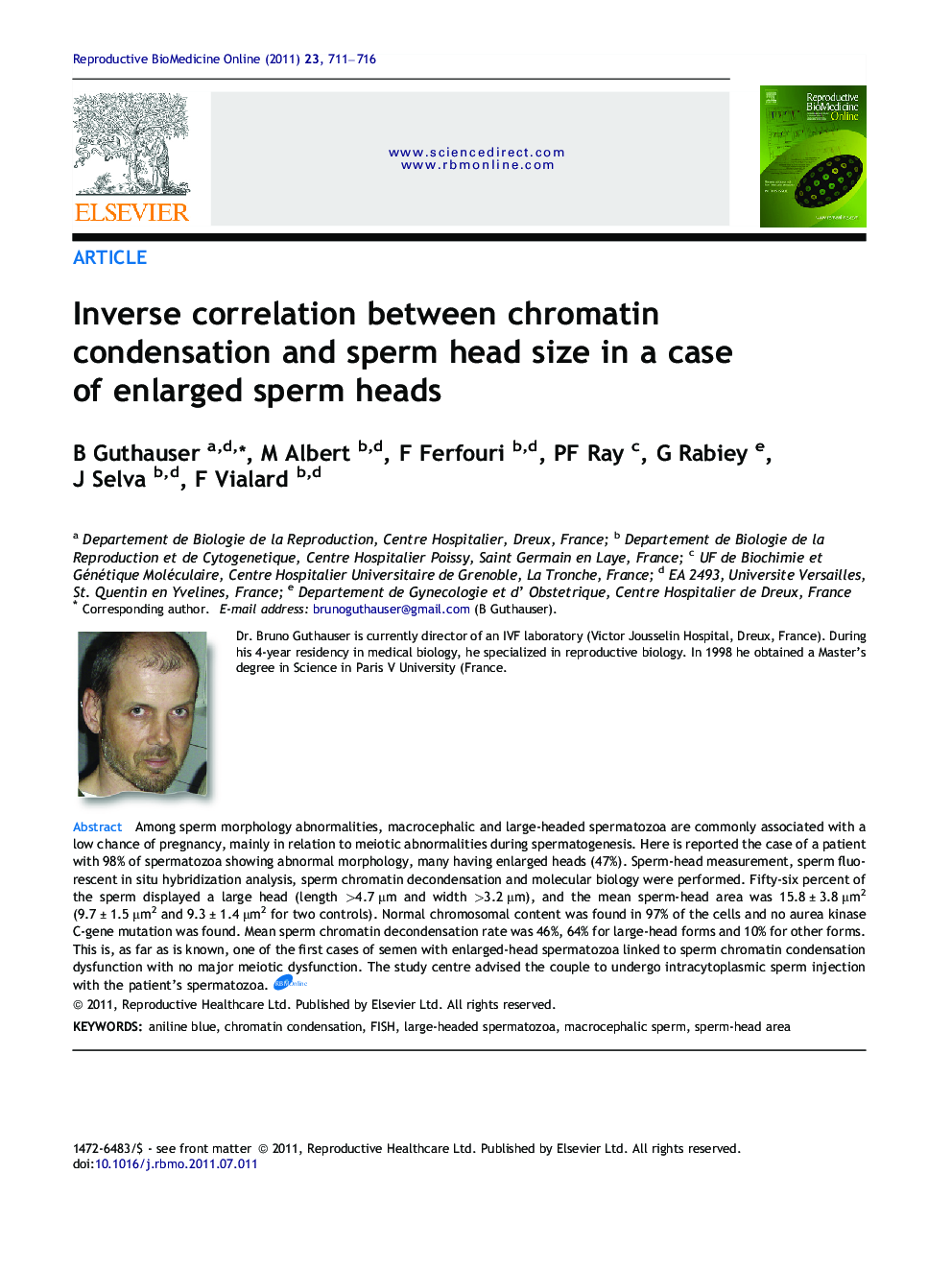 Inverse correlation between chromatin condensation and sperm head size in a case of enlarged sperm heads 