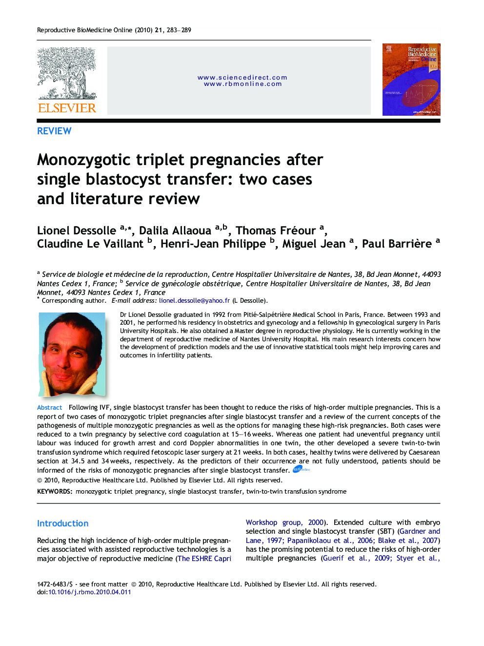 Monozygotic triplet pregnancies after single blastocyst transfer: two cases and literature review 