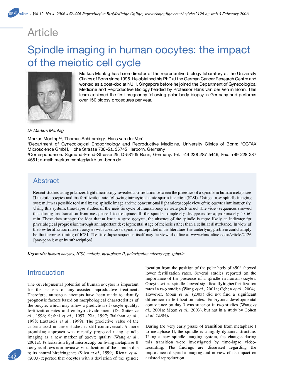 Spindle imaging in human oocytes: the impact of the meiotic cell cycle