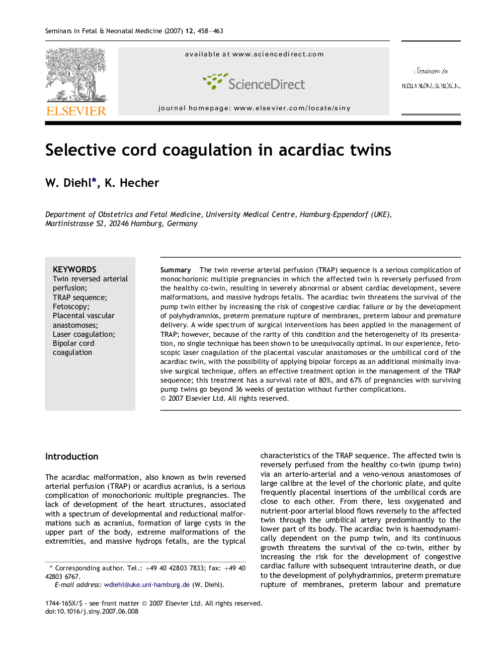 Selective cord coagulation in acardiac twins