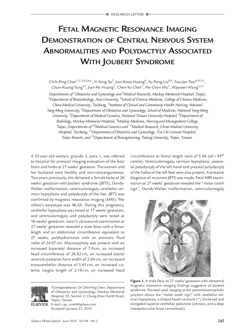 Fetal Magnetic Resonance Imaging Demonstration Of Central Nervous System Abnormalities and Polydactyly Associated With Joubert Syndrome