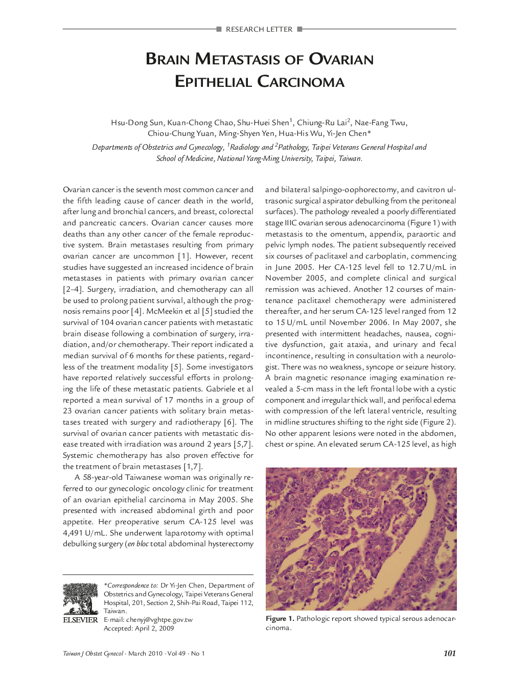 Brain Metastasis of Ovarian Epithelial Carcinoma