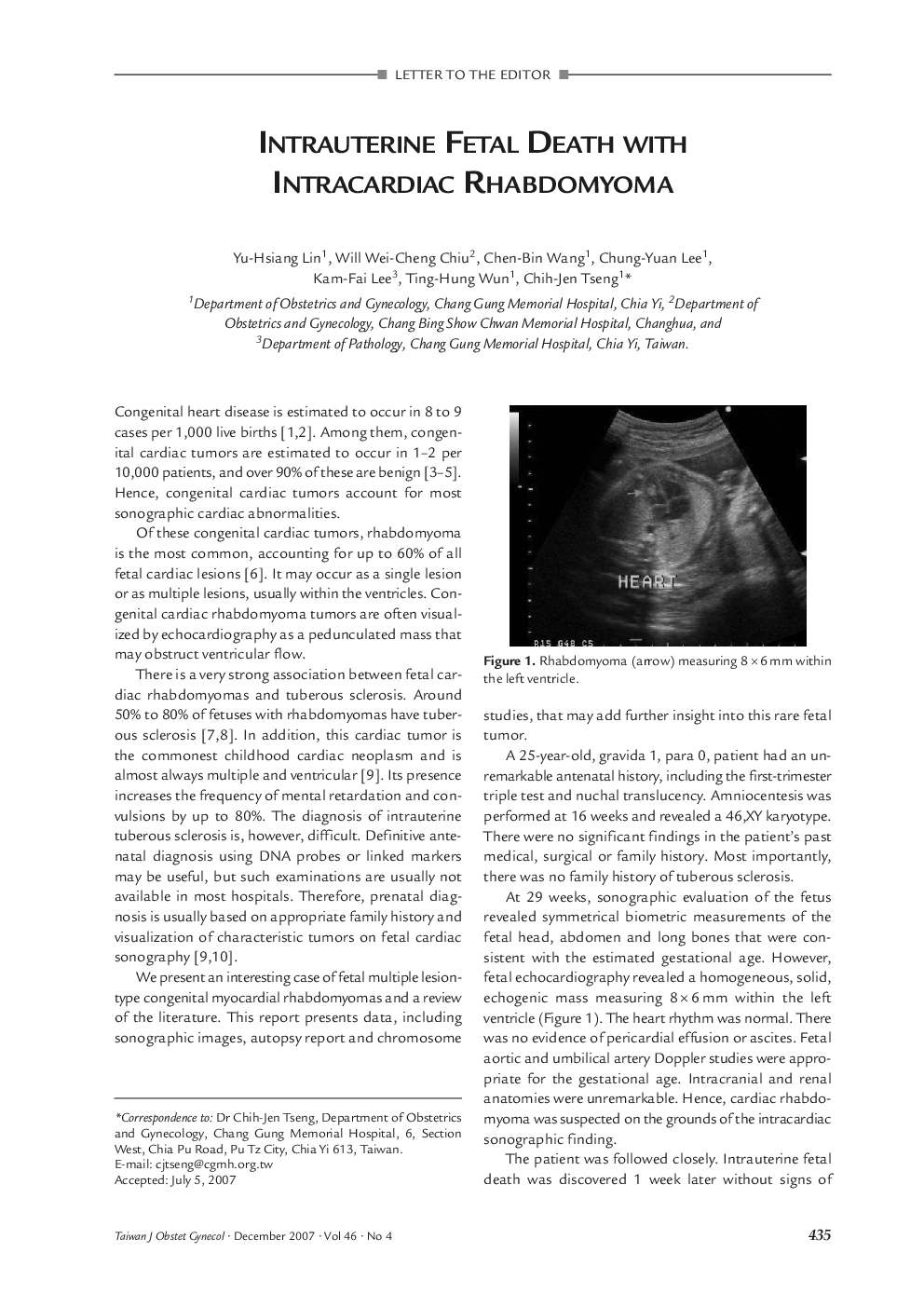 Intrauterine Fetal Death with Intracardiac Rhabdomyoma