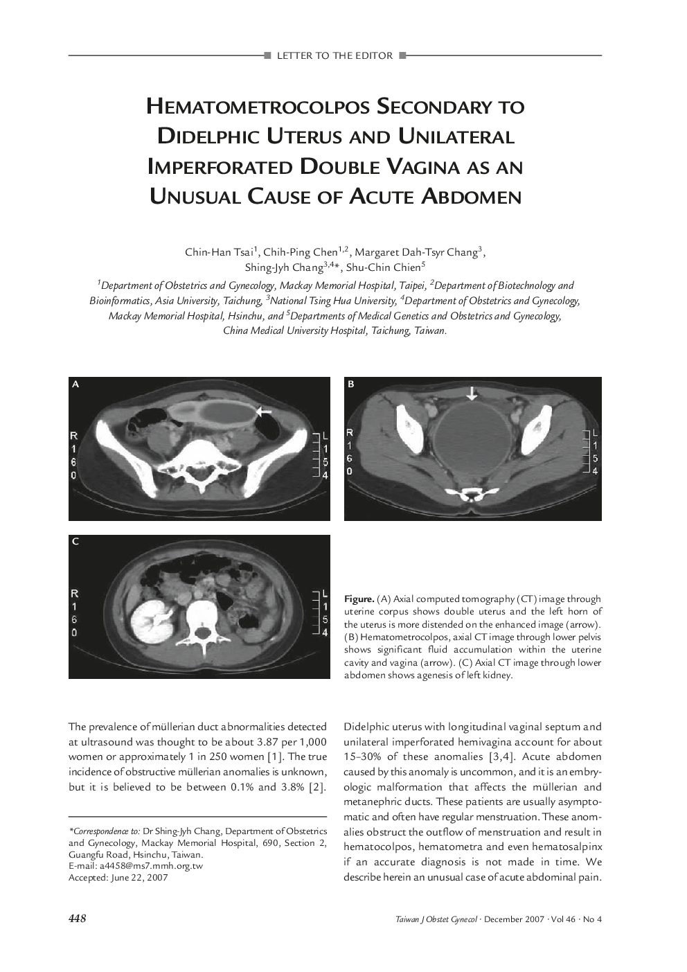 Hematometrocolpos Secondary to Didelphic Uterus and Unilateral Imperforated Double Vagina as an Unusual Cause of Acute Abdomen