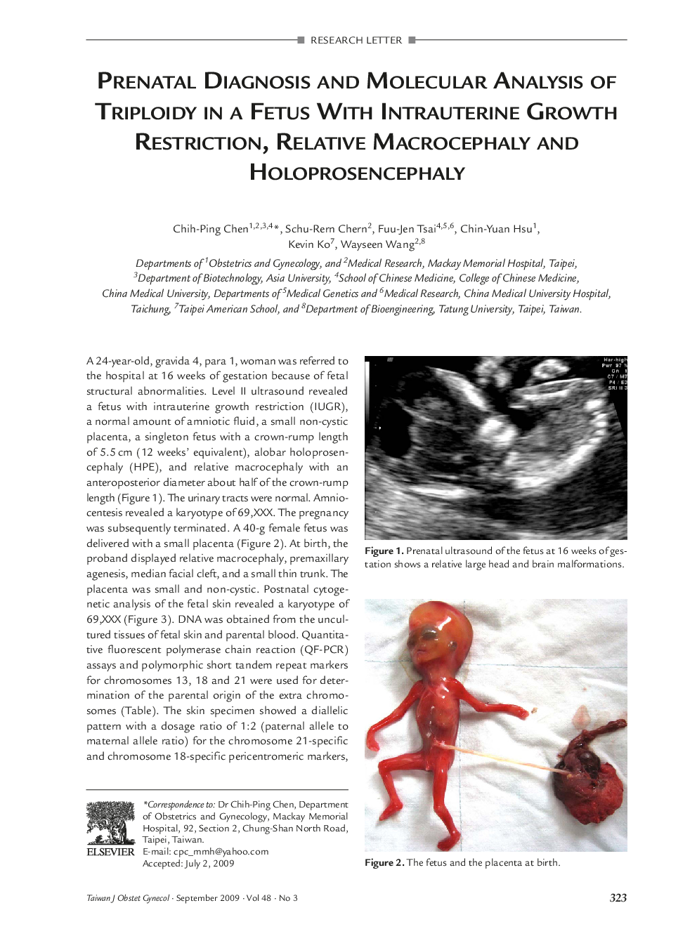 Prenatal Diagnosis and Molecular Analysis of Triploidy in a Fetus With Intrauterine Growth Restriction, Relative Macrocephaly and Holoprosencephaly