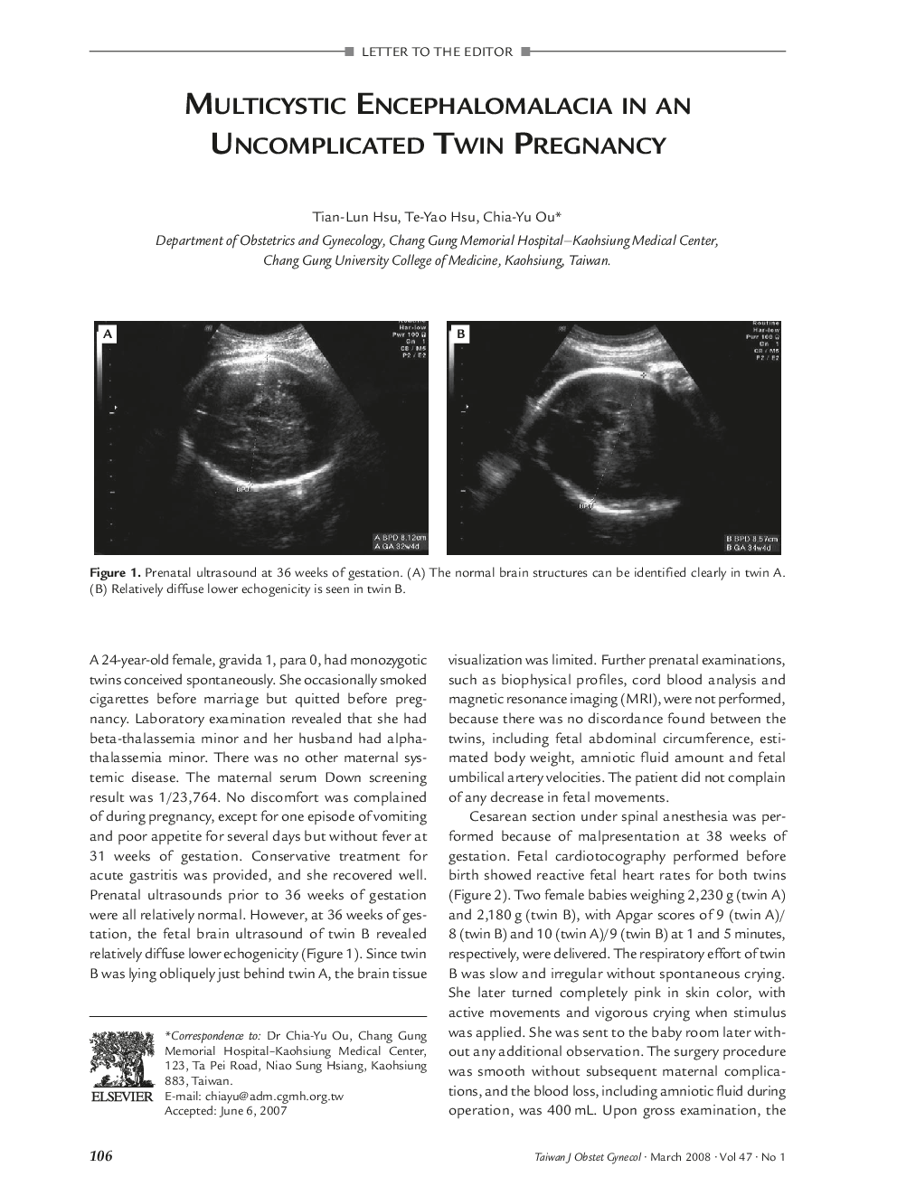 Multicystic Encephalomalacia in an Uncomplicated Twin Pregnancy