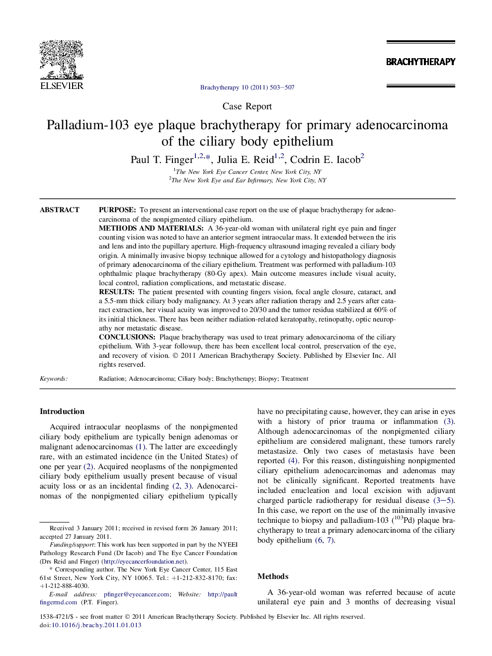 Palladium-103 eye plaque brachytherapy for primary adenocarcinoma of the ciliary body epithelium