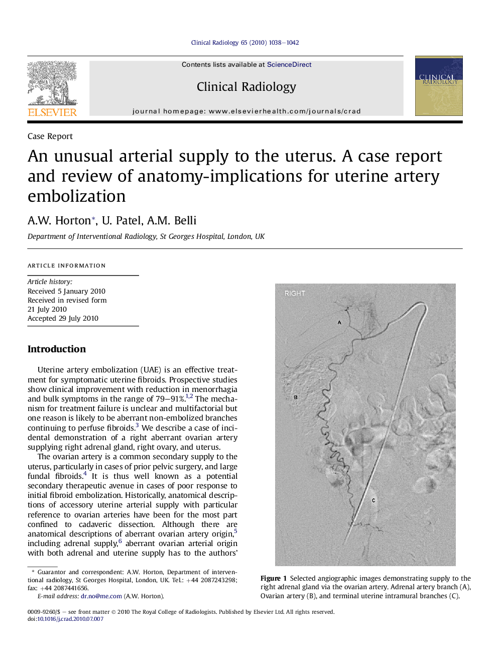 An unusual arterial supply to the uterus. A case report and review of anatomy-implications for uterine artery embolization