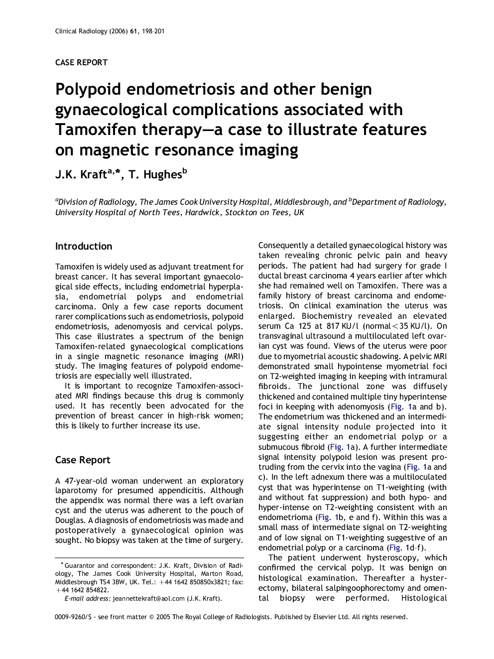 Polypoid endometriosis and other benign gynaecological complications associated with Tamoxifen therapy-a case to illustrate features on magnetic resonance imaging