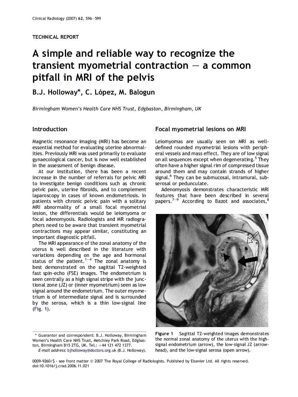 A simple and reliable way to recognize the transient myometrial contraction - a common pitfall in MRI of the pelvis