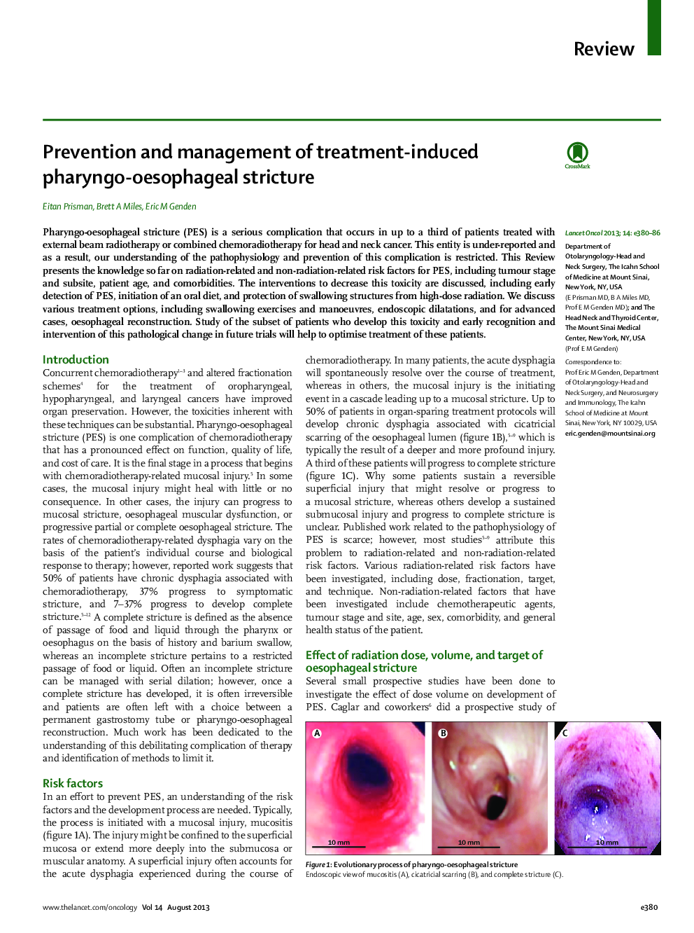 Prevention and management of treatment-induced pharyngo-oesophageal stricture