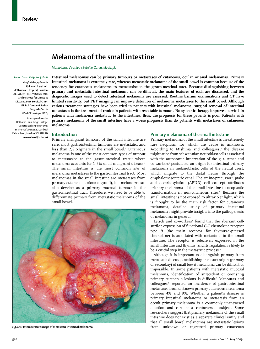 Melanoma of the small intestine